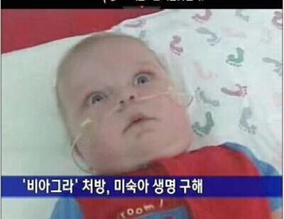 각성 신생아.jpg